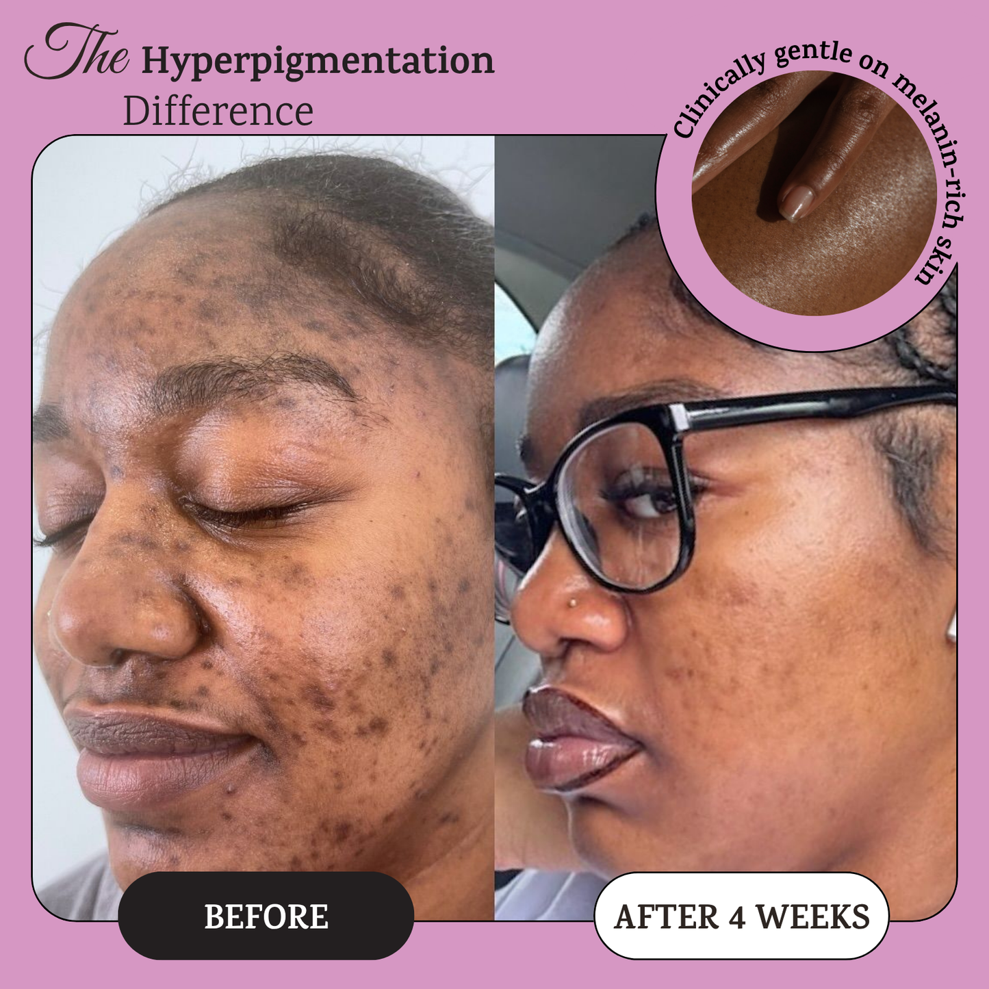 Turmeric Night Wrapping Mask