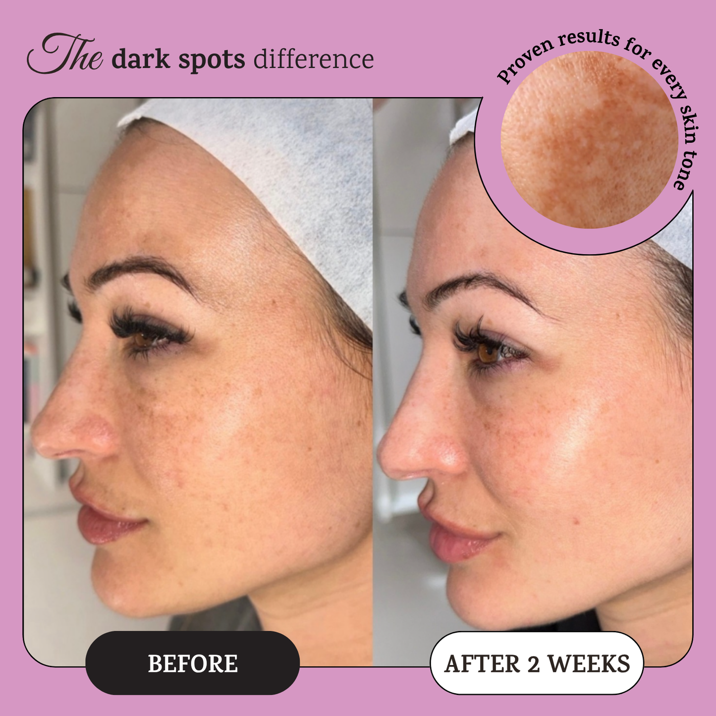 Turmeric Night Wrapping Mask