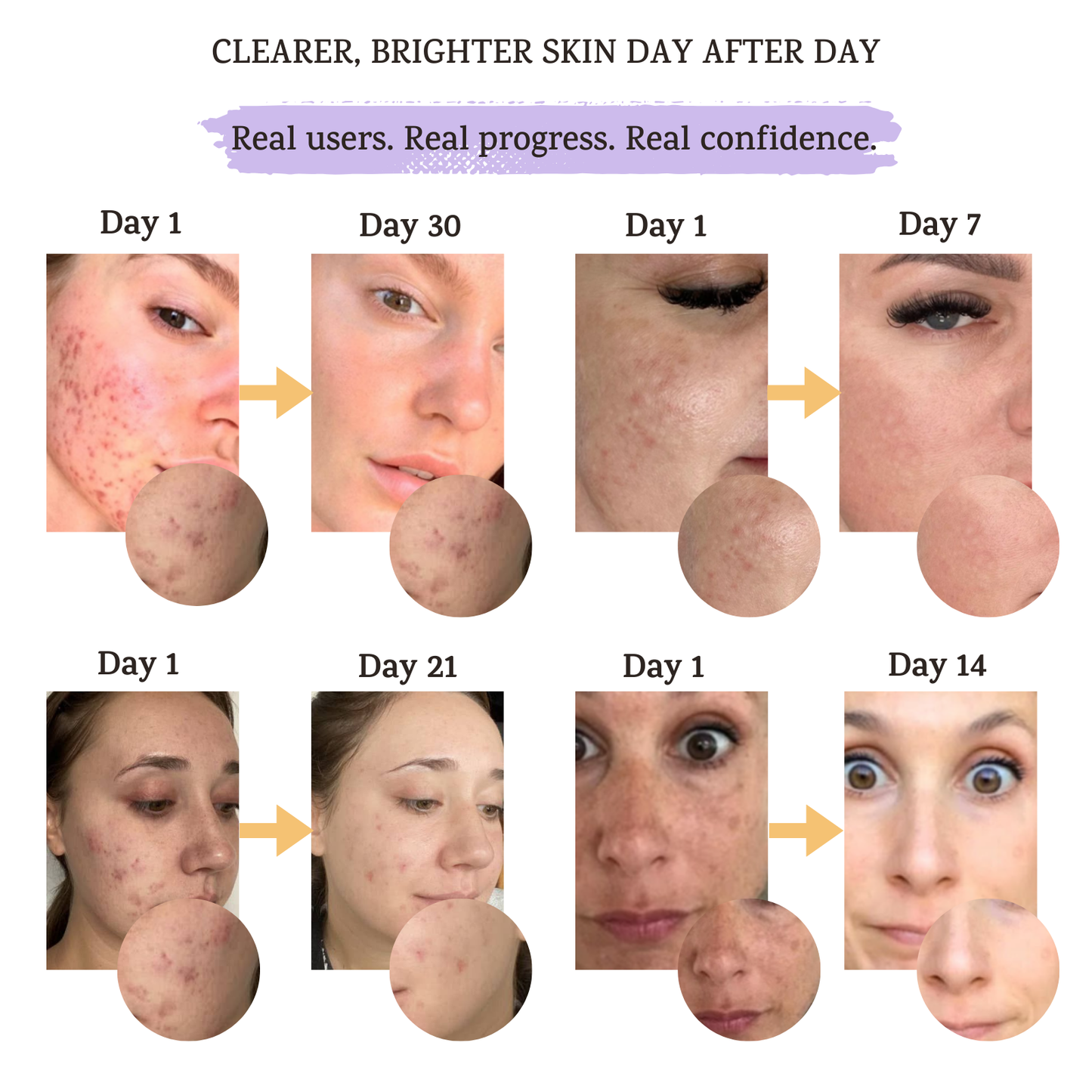 Turmeric  & Kojic Acid Facial Cleanser